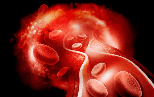 El 25% de las personas fallece por afecciones provocadas por&nbsp;trombosis